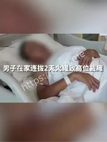 家庭拔火罐不当致瘫